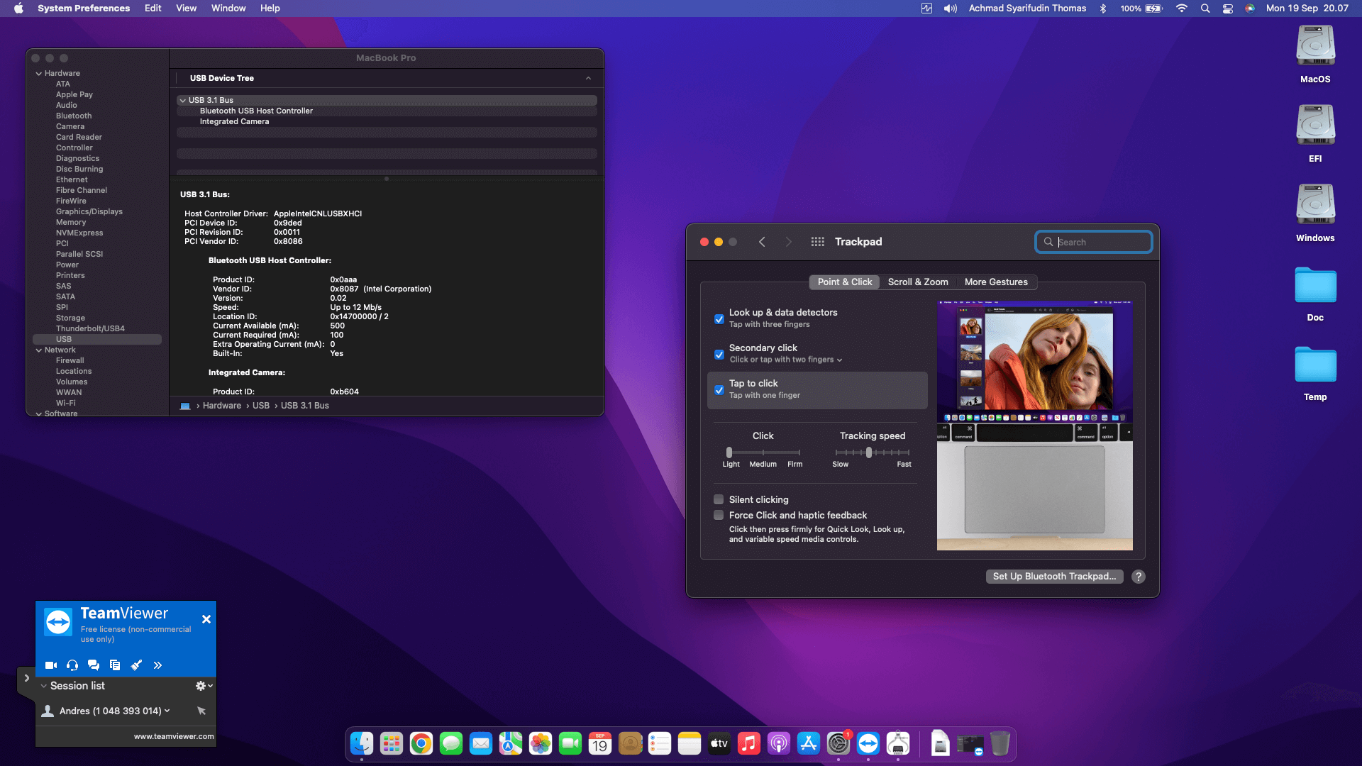 Lenovo Thinkpad L390 3rd   Touchscreen [WhiskeyLake   Intel UHD 620 + PS2]   OpenCore 4